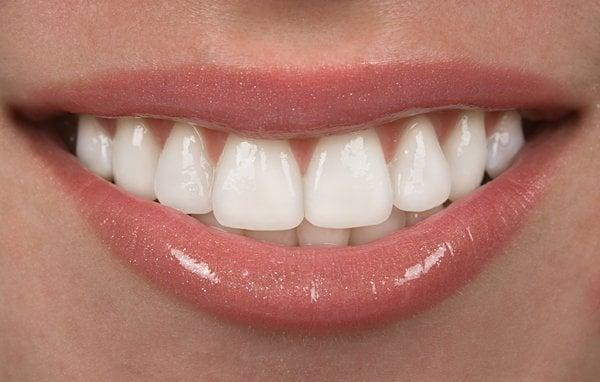 Porcelain Crowns and Veneers