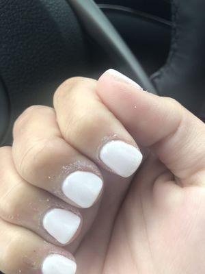 Botched cuticles.