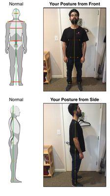 Get a biophysic analysis of your posture. This is your first step to the window of how you function and perform.