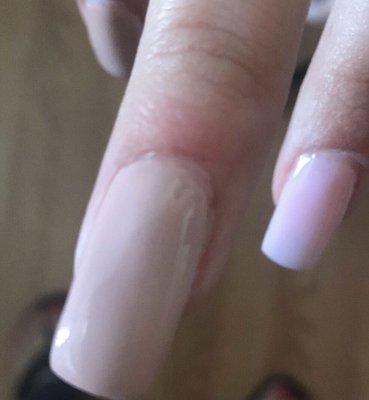 More skin agitated sure to bad cuticle job