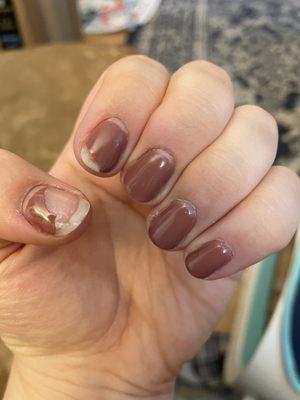 Peeling/chipped shellac manicure