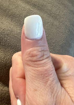 Crooked/slanted nail