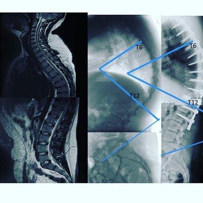 Before and after surgery