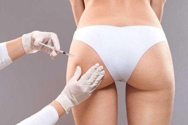 Qwo Cellulite Injectable treatment for treating the bands that create the cellulite dimples.