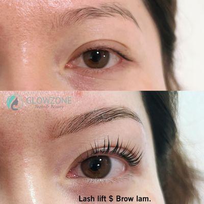 Eyelashlift + Brow Lamination with Henna Tint.