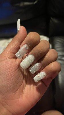 Messed up nails.