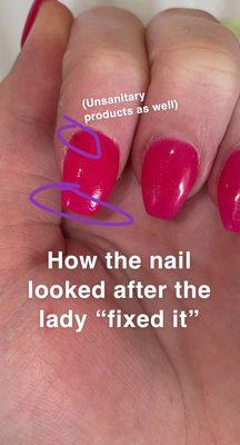 Uneven nail fix