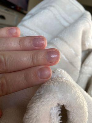 See the texture of my nails from when they peeled off the coating.. causing my nail to be very thin.