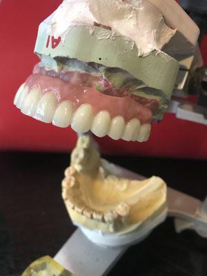 Screw Retained