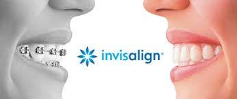 Are you a good candidate for Invisalign? Come in and find out!