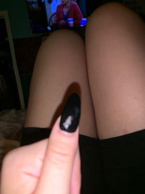 my nail color peeled off