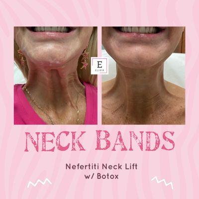 Neck Band Tox