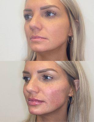 when it comes to injecting its important to assess the full face to optimally balance out the facial features