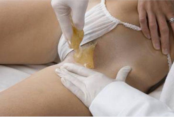 Sugaring hair removal