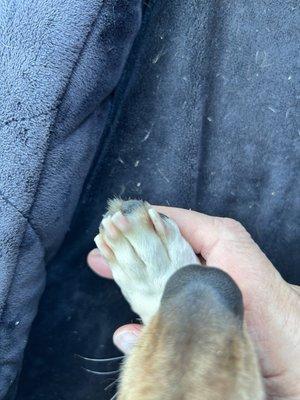 Nails cut into quick and bleeding.