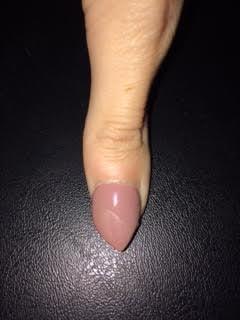 My thumb nail was not straight at all either. Pretty much ALL of my nails was crooked.