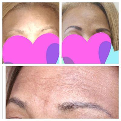 Here is an actual client's before after and healed. Client will return for a final touch up to darken brows a little more