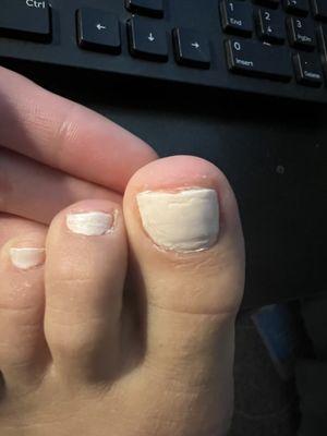 This was the pedicure I got yesterday ... I'm sure most of us can paint and cut our own toes better than this.