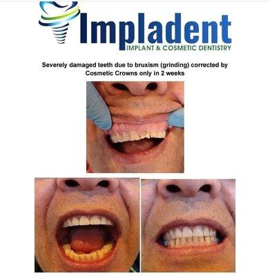 Impladent Implant & Cosmetic Dentistry Anaheim, CA