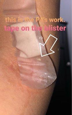 Blister attached to the band-aid