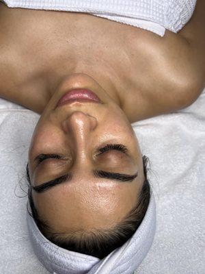 Dermaplane facial