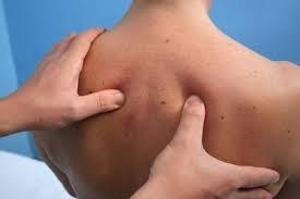 Acupressure massage Therapy