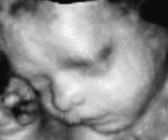 Our baby's 4d/3d pic!