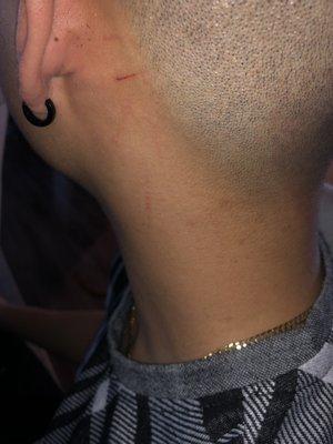 My bf got cut