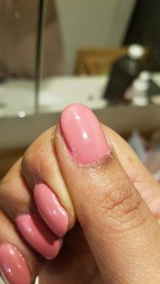 shellac spilled onto skin and left