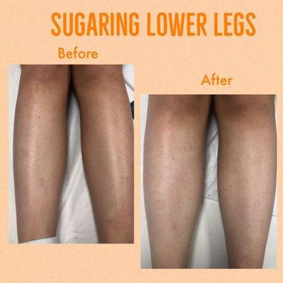 Lower Leg - Piernas Sugaring Hair Removal