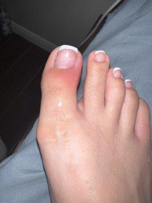 Te did my pedicure was really harsh cut and damaged my toes the pain I feel is horrible!