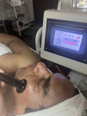 RF radio frequency facial