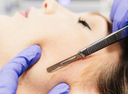 Dermaplaning:  Exfoliating of the skin that also removes thin, peach fuzz hair.