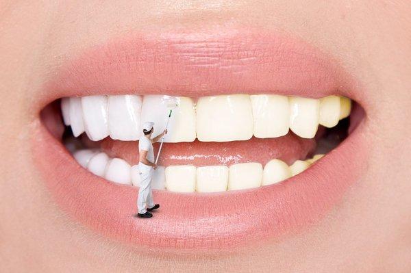 Tooth Whitening