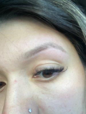 Left brow with hole