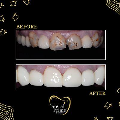 Every detail meticulously considered for a smile that reflects your unique radiance. Elevate your dental experience with us!