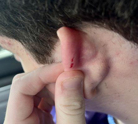 Careless. Tore a chunk out of my kid's ear with their shaver today. Hold the ear back when you use a shaver in that area!