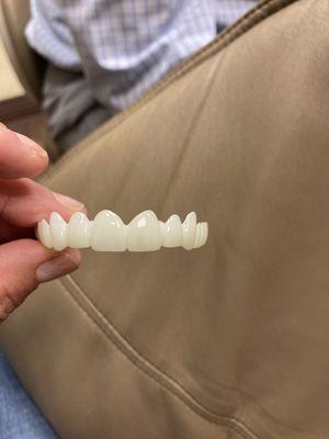 Temporary mouth piece showing what to expect.  I wore this to give the thumbs up on the permanent crowns.  Beautiful!