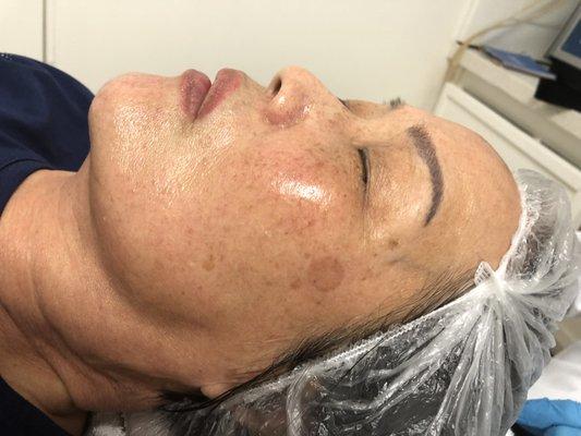 Dermalogica Pro Peel