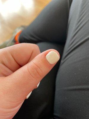 Bump in nail