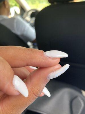 Better picture of the dent and crust residue on nails.