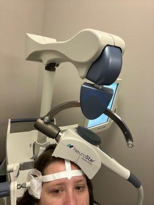 TMS Treatment