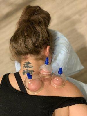 This treatment  ("Cupping") REALLY helped loosen up my shoulder and consequently my neck is moving MUCH better!