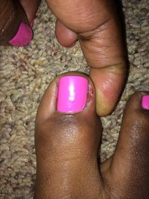 Day Two after my pedicure