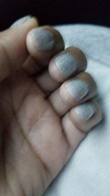 Horrible nails