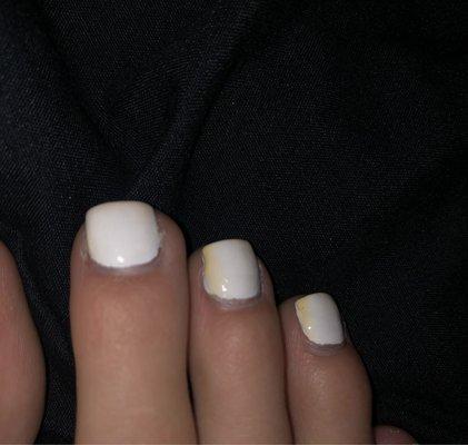 Yellowed white toe nails.