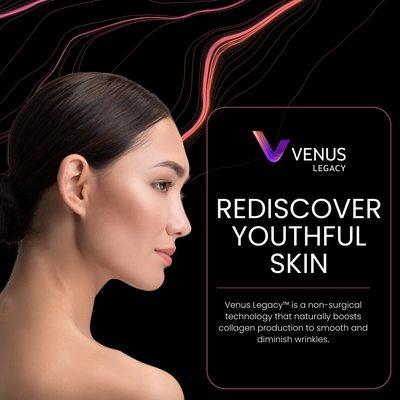 Venus Legacy  Skin tightening