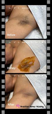 Underarm Honey Wax - Hermosa Beach