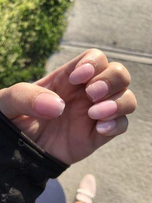 Middle finger and thumb and you can also see cracks on other nails