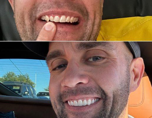 Actual cosmetic dentistry work by Adam Lords DMD.